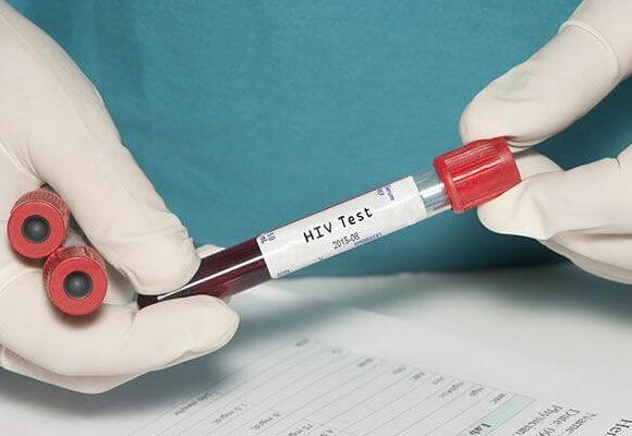 HIV-Hilfe