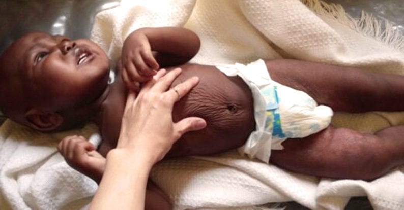 In Afrika Kindern helfen